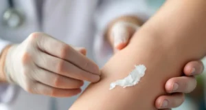 Peau qui pèle : causes et solutions