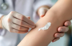 Peau qui pèle : causes et solutions