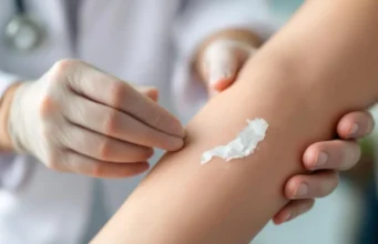Peau qui pèle : causes et solutions