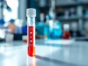 Les biomarqueurs dans le sang pour détecter votre consommation d’aliments ultra-transformés