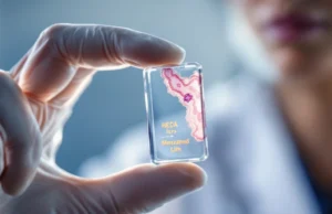 Une avancée révolutionnaire contre le cancer du sein une découverte qui pourrait sauver des millions de femmes