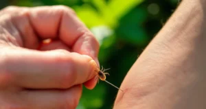 Attention aux astuces risquées pour retirer une tique cet été