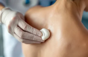 Kyste pilonidal : comment soulager la douleur et éviter l’opération