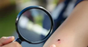 Piqûres d’insectes : comment reconnaître, agir et éviter le danger