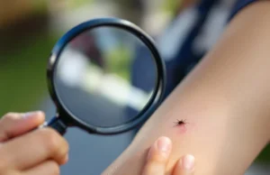 Piqûres d’insectes : comment reconnaître, agir et éviter le danger