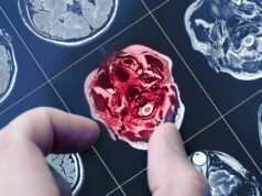 Ces stars touchées par la maladie d’Alzheimer