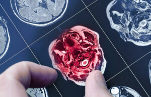 Ces stars touchées par la maladie d’Alzheimer