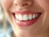Découvrez pourquoi vos dents jaunissent malgré une hygiène irréprochable