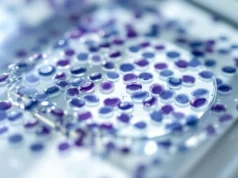 Monocytes en gras dans votre sang : ce que cela révèle sur votre santé